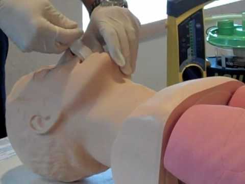 Insert an Oropharyngeal Airway Thumbnail